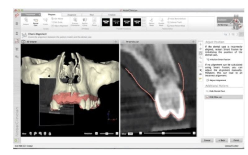 土屋歯科クリニック&works スマートヒュージョン(CTデータ解析・診断設計システム)
