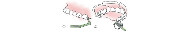 歯磨きの仕方